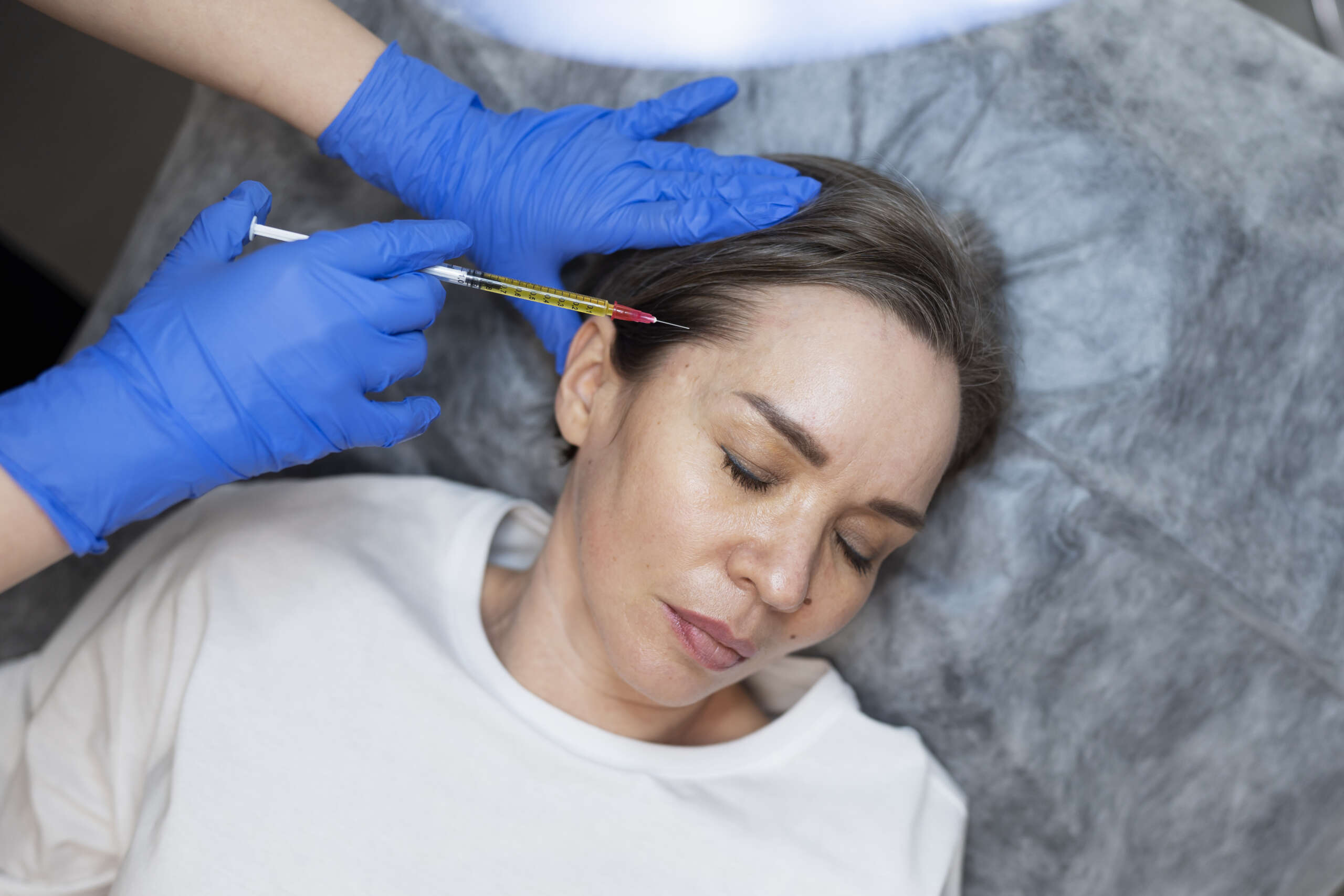 PRP Treatments