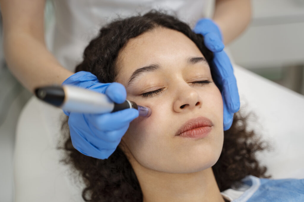 patient undergoing microneedling procedure 1